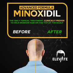 Elevate herbal infused formula bottle highlighting scalp nourishment ingredients