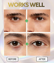 Elixbloom retinol niacinamide under-eye formula smooths and firms
