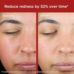 EltaMD UV Skin Recovery soothing ceramides and Cica visible on skin texture.