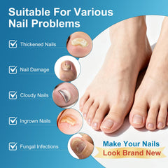 Brush tip applying liquid to a yellowed toenail for controlled coverage.