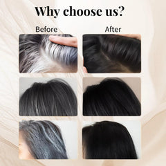 FHH Root coverage focuses on white hair for natural blending at the hairline.