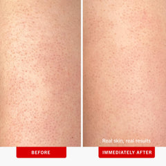 Packaging highlights 10% AHA exfoliation in First Aid Beauty KP Bump Eraser.