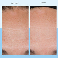 First Aid Beauty peptides niacinamide ingredients label emphasizes key skin-supporting components.