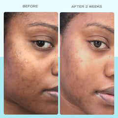 First Aid Beauty serum texture close-up reveals a lightweight, non-greasy finish.