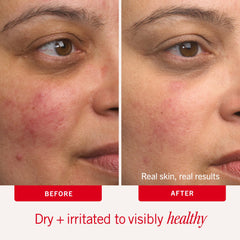 First Aid Beauty Ultra Repair Cream on elbow demonstrates rich hydration on rough areas.