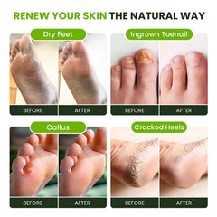 FOOT CURE american-made-foot-soak packaging showcases quality.