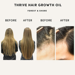 Forest & Shore rosemary oil drops focus on scalp care and growth support