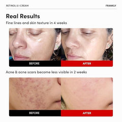 FRANKLY retinol applied to skin showing smoothing potential