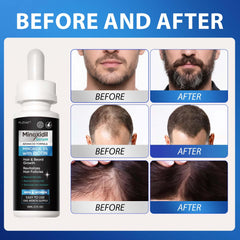 FUZYAT Lightweight non-greasy formula shown absorbing into the scalp