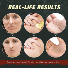 Generic Beeswax barrier moisturizer locks in moisture while breathable