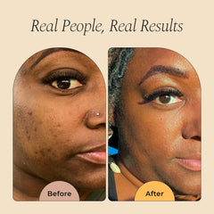 Glo Melanin turmeric scrub on face in use demonstrates gentle brightening.