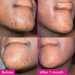 Good Molecules Brightening Dark Spots Bar closeup emphasizes fragrance-free, skin-friendly cleansing
