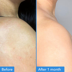 Good Molecules Discoloration Correcting Body Treatment applied on arm for targeted brightening.