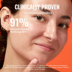 Pimple patches applied on skin for concealment