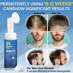 Close-up of Greoay Minoxidil foam pump for precise, even application.
