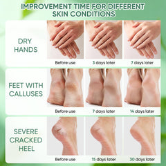Grocerism Urea Cream with tea tree and aloe soothes and repairs skin barrier.