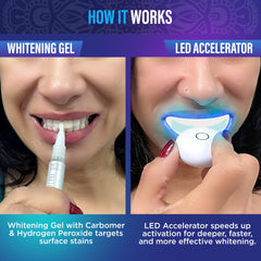 GuruNanda whitening pen for precise application on each tooth.