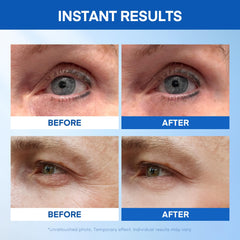 HealthyDerm Instant Eye Lift Serum applied under the eye for a smoother look.