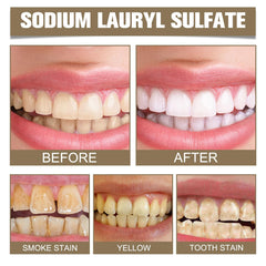 HONGYUNDA enamel-care gentle cleaning demonstrates enamel-friendly action