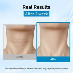 HONLINK hydration with hyaluronic acid and glycerin
