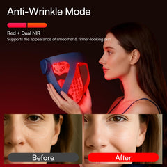 INIA Glow 4D cooling pad provides under-eye relief during sessions.