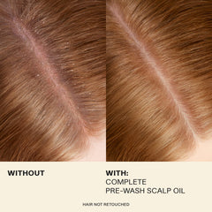 JVN Complete Pre-Wash Scalp Oil dropper close-up for precise application