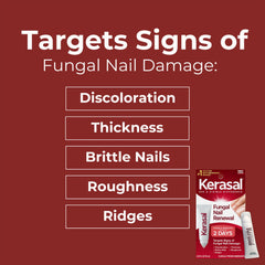 Kerasal Nail Renewal packaging on shelf indicating availability