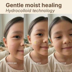 Ellipse MoistureBand 9pcs with flexible fit for active kids