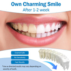 KTSAY Teeth Whitening Pen brush tip enables precise, stain-targeted application.