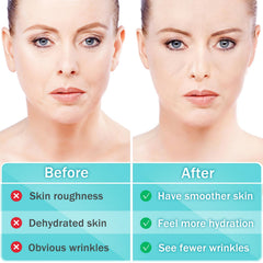 LadPemo crow-feet patch overnight reduces eye wrinkles