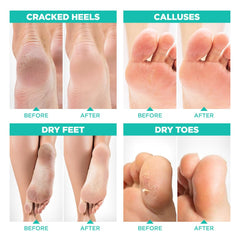 Lavinso foot peel mask worn on feet during application for at-home exfoliation
