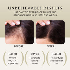 Lebanta Hair Growth Oil Spray delivers a healthy shine and frizz control.