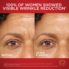 L'Oreal Paris Revitalift Vitamin C component signals brightening and even tone.