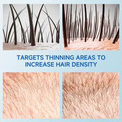 Loreviya Rollerball design delivers precise scalp application with minimal waste.