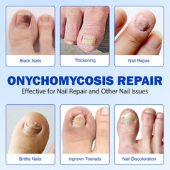 LTQXGT Fungal Nail Patches application steps showing quick at-home use.