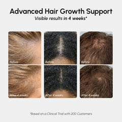 MAREE Hair Growth Spray root application targets the scalp for better reach.