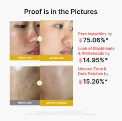 Medicube Peel Shot with Turmeric highlights multi-acid blend for gentle exfoliation.