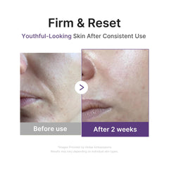 Medicube Retinol Boosting Serum with peptide blend close-up for firmer-looking skin