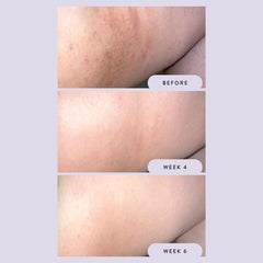 Megababe Night Rescue application on arm illustrates even tone benefits.