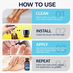 MEOLY freeze-off action application shows rapid wart surface treatment when used properly.