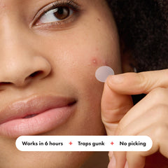 Mighty Patch Original removed in the morning reveals absorbed gunk and clearer-looking skin.