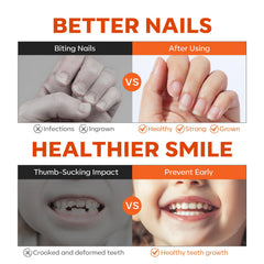 Modelones bitter flavor memory helps discourage nail biting in kids