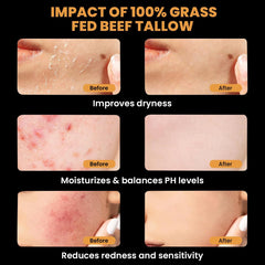 MONIER balm texture demonstrates nourishing feel for dry skin