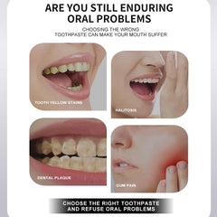 MOONGAZE 2-pack back view highlights fluoride-free formula for sensitive teeth.