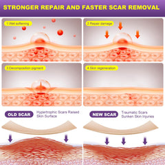 MUKBEA scar strip on keloid bump area with smooth, flexible silicone.