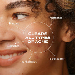 Murad Biome-Balancing Serum dropper cap shown for precise dosing.