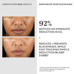 Murad Rapid Relief Acne Sulfur Mask Austrian peat extract highlighted for redness reduction.