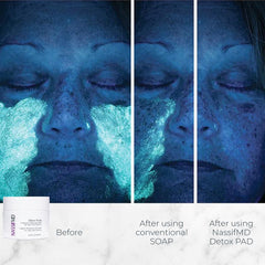 NassifMD Detox Pads on hand show easy nightly use for refreshed skin