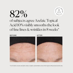 Naturium Azelaic Topical Acid 10% ingredients image highlights niacinamide and vitamin C