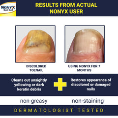 NONYX nails before and after showing improved appearance.